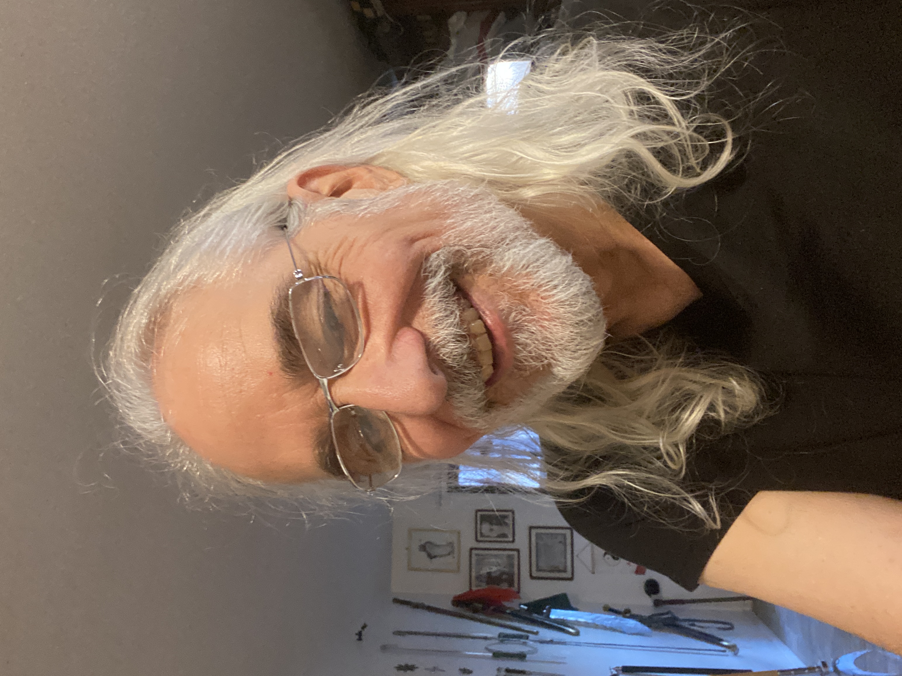 Richard Del Connor after chemotherapy.